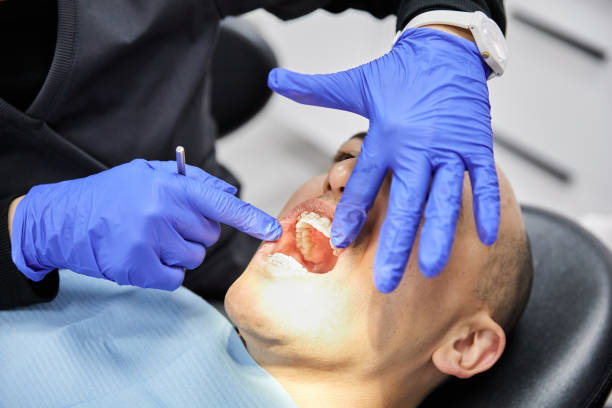 Best Emergency Dental Care for Trauma or Injury in Forest Meadows, CA