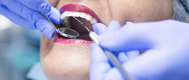 Best Emergency Root Canal Treatment in Forest Meadows, CA